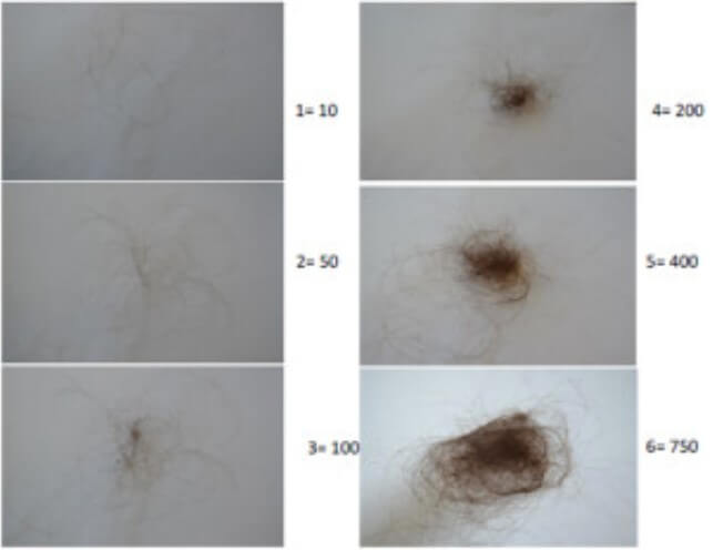 how-to-tell-if-your-losing-too-much-hair-sinclair-dermatology