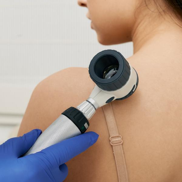 Skin Cancer Check Ups